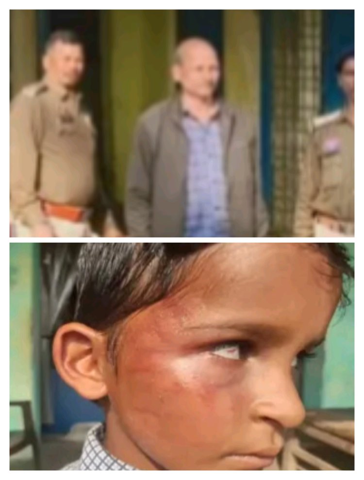 दूसरी कक्षा के बच्चे के साथ क्रूरतापूर्वक मारपीट करने वाला शिक्षक गिरफ्तार कर भेजा गया जेल  नशे की हालत में स्कूल के शिक्षक ने मात्र गिनती नहीं सुनाने पर बच्चे को कई थप्पड़ मार दिए थे