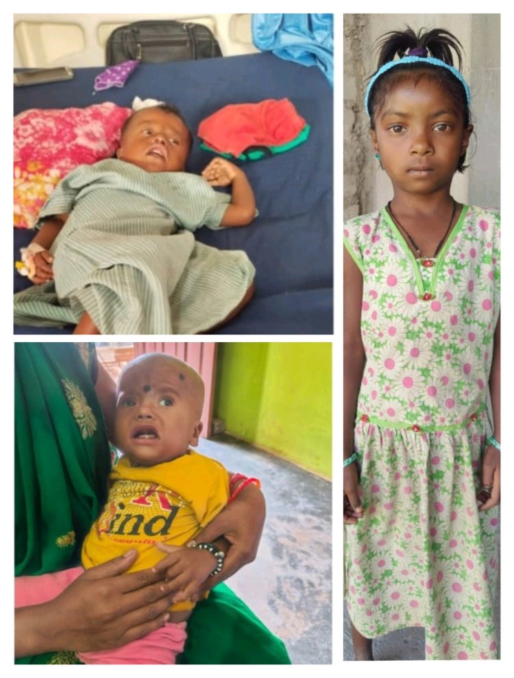 रायपुर में तीन बच्चों का चिरायु योजना से हुआ निःशुल्क सफल ऑपरेशन,  परिजनों ने मुख्यमंत्री विष्णुदेव साय के प्रति जताया आभार