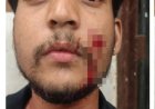 गाली देने से रोका तो नाबालिग ने युवक का गला रेता, चेहरे पर भी किया चाकू से हमला