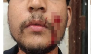 गाली देने से रोका तो नाबालिग ने युवक का गला रेता, चेहरे पर भी किया चाकू से हमला