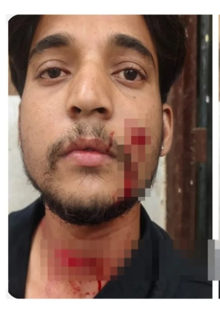 गाली देने से रोका तो नाबालिग ने युवक का गला रेता, चेहरे पर भी किया चाकू से हमला