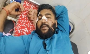 *चखना सेंटर में 70 रुपए के लिए चला चाकू, बाप - बेटे ने युवक पर चाकू से किया हमला, बीच-बचाव करने आए दोस्त को भी मारा*